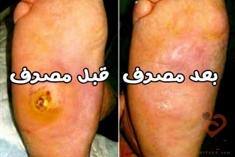 محصولات درمانی