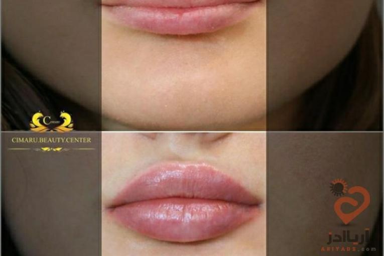 تزریق بوتاکس و تزریق چربی، لیزر موهای زائد، میکرونیدلینگ پوست