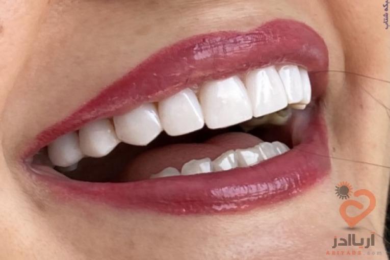 مرکز دندانپزشکی مریشا