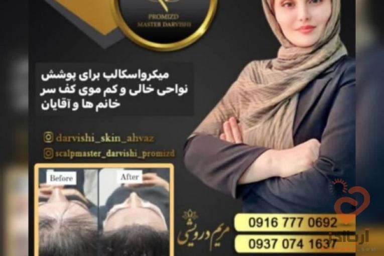 میکرواسکالپ سر
