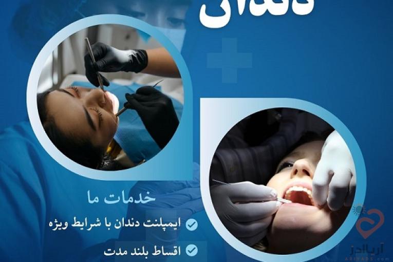 ایمپلنت دندان در مشهد – از دم قسط، بدون سود و بهره!