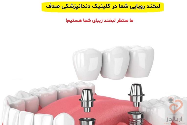 ایمپلنت دندان در مشهد ، کلینیک صدف