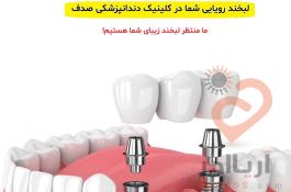 ایمپلنت دندان در مشهد ، کلینیک صدف